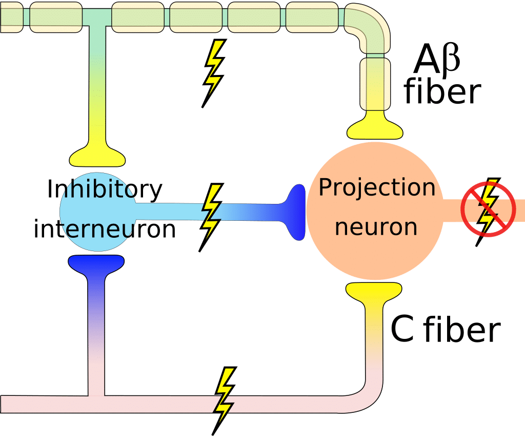 Melzack and Wall's Gate Theory of Pain