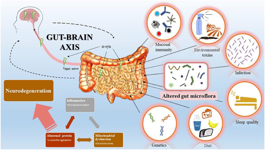 Diagram showing the gut brain axis, with arrows connecting the brain and gut, highlighting factors like trauma, immunity,...